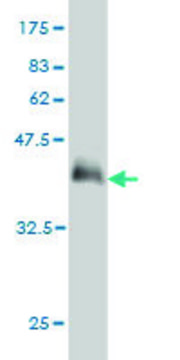 Monoclonal Anti-PHF21A antibody produced in mouse clone 5A6, purified immunoglobulin, buffered aqueous solution