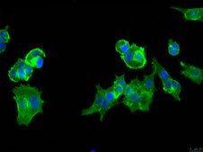 MCF-7 BUS Human Invasive Ductal Carcinoma Cell Line