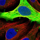Anti-GAPDH antibody produced in rabbit Prestige Antibodies&#174; Powered by Atlas Antibodies, affinity isolated antibody