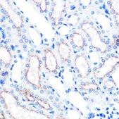 Anti-LAMP2 antibody produced in rabbit