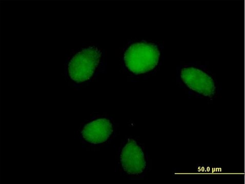 Anti-HUS1 antibody produced in mouse purified immunoglobulin, buffered aqueous solution