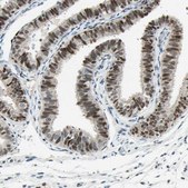 Anti-RNF43 antibody produced in rabbit Prestige Antibodies&#174; Powered by Atlas Antibodies, affinity isolated antibody, buffered aqueous glycerol solution