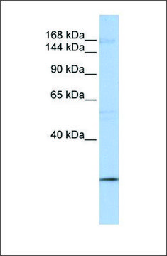 Anti-UBR2 antibody produced in rabbit affinity isolated antibody