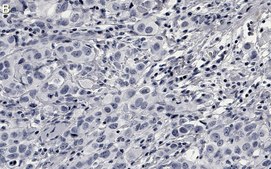Anti-Phospho-AKT1-(Ser473) Antibody, clone 1O14 ZooMAb&#174; Rabbit Monoclonal recombinant, expressed in HEK 293 cells