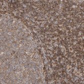Anti-ANXA11 antibody produced in rabbit Prestige Antibodies&#174; Powered by Atlas Antibodies, affinity isolated antibody, buffered aqueous glycerol solution