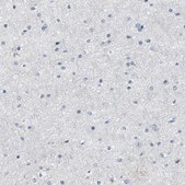 Anti-MYH3 antibody produced in rabbit Prestige Antibodies&#174; Powered by Atlas Antibodies, affinity isolated antibody, buffered aqueous glycerol solution