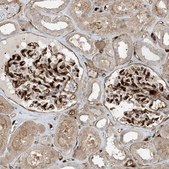 Anti-PPM1F antibody produced in rabbit Prestige Antibodies&#174; Powered by Atlas Antibodies, affinity isolated antibody, buffered aqueous glycerol solution