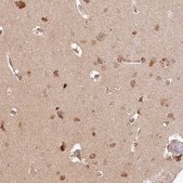 Anti-INPP4B antibody produced in rabbit Prestige Antibodies&#174; Powered by Atlas Antibodies, affinity isolated antibody, buffered aqueous glycerol solution