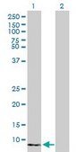 Anti-S100A8 antibody produced in rabbit purified immunoglobulin, buffered aqueous solution