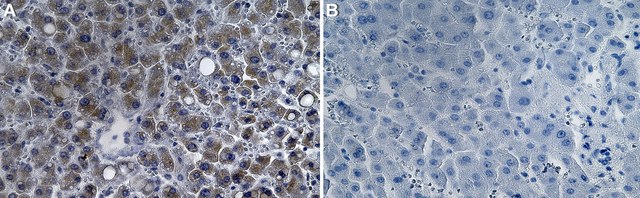 Anti-CPT2 Antibody, clone 1G7 ZooMAb&#174; Rabbit Monoclonal recombinant, expressed in HEK 293 cells