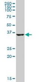 Anti-HSD17B2 antibody produced in mouse IgG fraction of antiserum, buffered aqueous solution