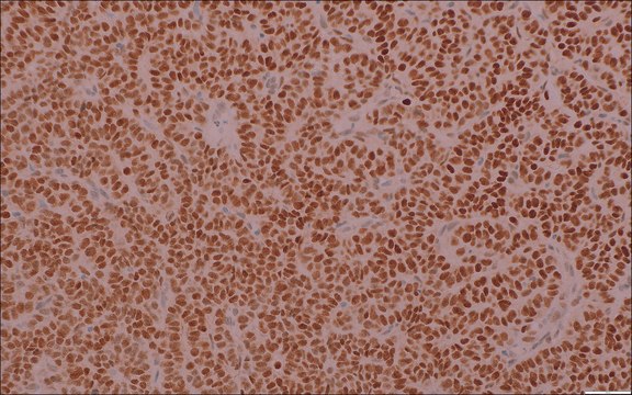 SF-1 (EP434) Rabbit Monoclonal Primary Antibody