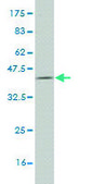 Monoclonal Anti-PFKL antibody produced in mouse clone 2A9, purified immunoglobulin, buffered aqueous solution