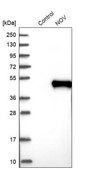 Anti-NOV antibody produced in rabbit Prestige Antibodies&#174; Powered by Atlas Antibodies, affinity isolated antibody, buffered aqueous glycerol solution, Ab2