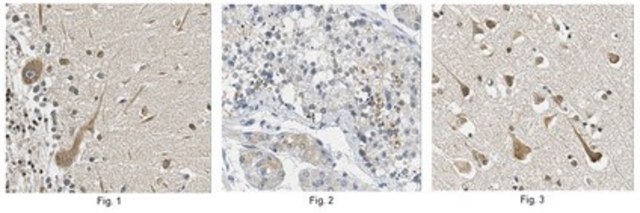 Anti-MCPH1 Antibody from rabbit, purified by affinity chromatography