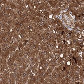 Anti-RSAD2 antibody produced in rabbit Prestige Antibodies&#174; Powered by Atlas Antibodies, affinity isolated antibody, buffered aqueous glycerol solution