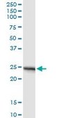 Monoclonal Anti-APOA1 antibody produced in mouse clone 3A11-1A9, purified immunoglobulin, buffered aqueous solution