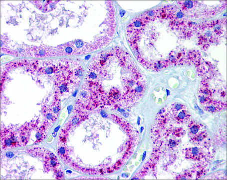 Anti-PTCH1 antibody produced in rabbit affinity isolated antibody