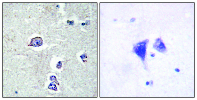 Anti-PDGFR &#945; antibody produced in rabbit affinity isolated antibody