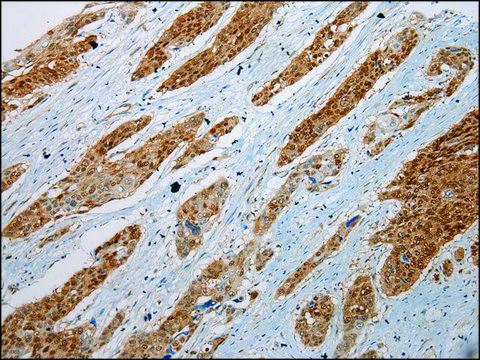 Anti-GSTM4 affinity isolated antibody