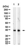 Anti-RANKL/TNFSF11 Antibody, clone 1H17 ZooMAb&#174; Rabbit Monoclonal recombinant, expressed in HEK 293 cells