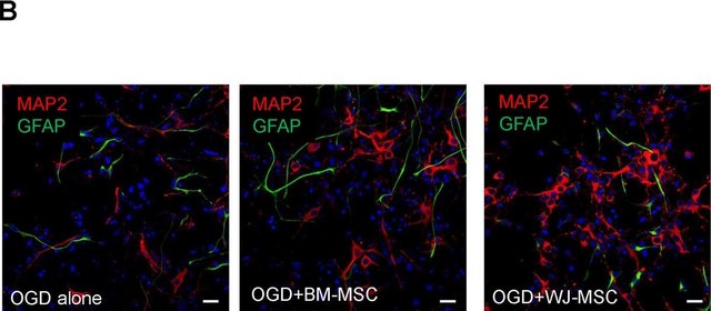 Anti-MAP2 Antibody, clone AP20 clone AP20, Chemicon&#174;, from mouse