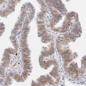 Anti-EPCAM antibody produced in rabbit Prestige Antibodies&#174; Powered by Atlas Antibodies, affinity isolated antibody, buffered aqueous glycerol solution