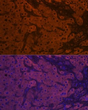 Anti-ApoM antibody produced in rabbit