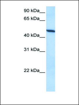 Anti-ADAM33 antibody produced in rabbit affinity isolated antibody