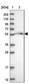 Anti-MGAT2 antibody produced in rabbit Prestige Antibodies&#174; Powered by Atlas Antibodies, affinity isolated antibody, buffered aqueous glycerol solution