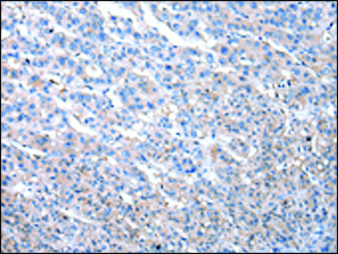 Anti-MASP1 affinity isolated antibody