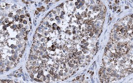 Anti-G3BP1 Antibody, clone 1B10 ZooMAb&#174; Rabbit Monoclonal recombinant, expressed in HEK 293 cells