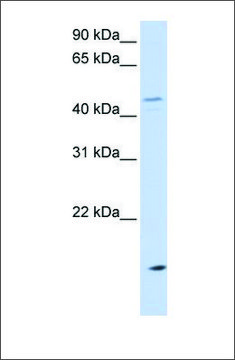 Anti-CETP antibody produced in rabbit affinity isolated antibody