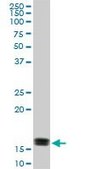 Monoclonal Anti-ACP1 antibody produced in mouse clone 4B10, purified immunoglobulin, buffered aqueous solution