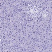 Anti-PATE4 antibody produced in rabbit Prestige Antibodies&#174; Powered by Atlas Antibodies, affinity isolated antibody, buffered aqueous glycerol solution