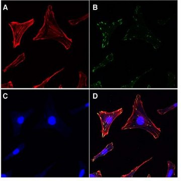 Actin Cytoskeleton / Focal Adhesion Staining Kit The Actin Cytoskeleton &amp; Focal Adhesion Staining Kit consists of TRITC-conjugated phalloidin, anti-Vinculin &amp; DAPI for the immunofluorescent staining of actin filaments in the cytoskeleton as well as the nucleus of the cells.