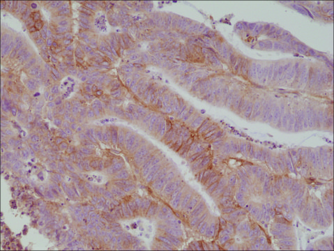 Anti-CD276 (B7-H3) antibody, Rabbit monoclonal recombinant, expressed in HEK 293 cells, clone RM335, purified immunoglobulin