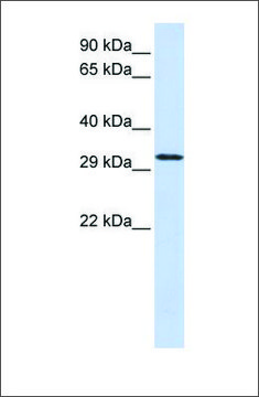 Anti-C21ORF2 antibody produced in rabbit affinity isolated antibody