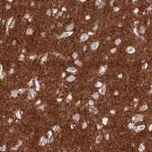 Anti-ATP1A3 antibody produced in rabbit Prestige Antibodies&#174; Powered by Atlas Antibodies, affinity isolated antibody, buffered aqueous glycerol solution