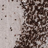Monoclonal Anti-PARP1 Prestige Antibodies&#174; Powered by Atlas Antibodies, clone CL2209, purified immunoglobulin, buffered aqueous glycerol solution