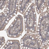 Anti-PDK1 antibody produced in rabbit Prestige Antibodies&#174; Powered by Atlas Antibodies, affinity isolated antibody, buffered aqueous glycerol solution