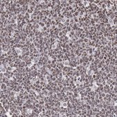 Anti-NKAP antibody produced in rabbit Prestige Antibodies&#174; Powered by Atlas Antibodies, affinity isolated antibody, buffered aqueous glycerol solution
