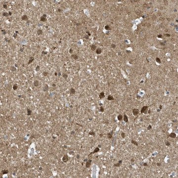 Anti-NCOA7 antibody produced in rabbit Prestige Antibodies&#174; Powered by Atlas Antibodies, affinity isolated antibody, buffered aqueous glycerol solution