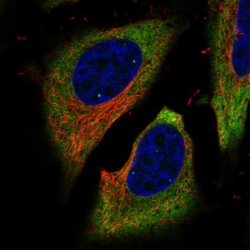 Anti-FAM134B antibody produced in rabbit Prestige Antibodies&#174; Powered by Atlas Antibodies, affinity isolated antibody