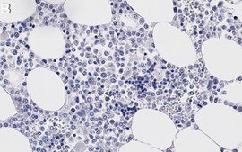 Anti-Myeloperoxidase Antibody, clone 1F8 ZooMAb&#174; Rabbit Monoclonal recombinant, expressed in HEK 293 cells