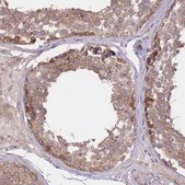 Anti-PFDN6 antibody produced in rabbit Prestige Antibodies&#174; Powered by Atlas Antibodies, affinity isolated antibody, buffered aqueous glycerol solution