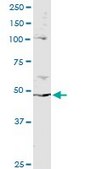 Monoclonal Anti-PPP2R2B antibody produced in mouse clone 1F3, purified immunoglobulin, buffered aqueous solution