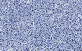 Anti-SEC61B Antibody, clone 1G14 ZooMAb&#174; Rabbit Monoclonal recombinant, expressed in HEK 293 cells