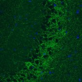 Monoclonal Anti-GAD1 antibody produced in mouse Prestige Antibodies&#174; Powered by Atlas Antibodies, clone CL2914, purified immunoglobulin, buffered aqueous glycerol solution