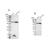 Anti-ME2 antibody produced in rabbit Prestige Antibodies&#174; Powered by Atlas Antibodies, affinity isolated antibody, buffered aqueous glycerol solution